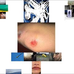 Remo Helfenstein Spite (LP)