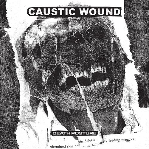 Caustic Wound Death Posture (LP)