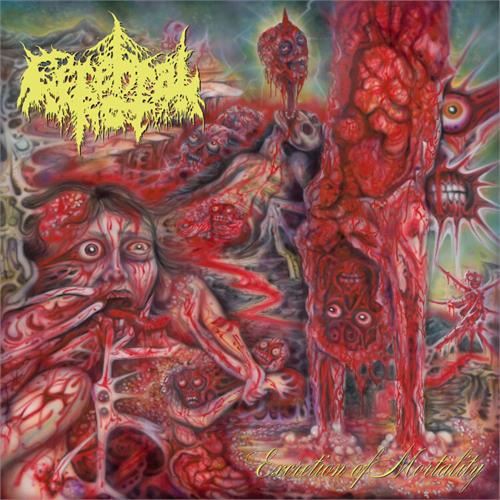 Cerebral Rot Excretion Of Mortality (LP)